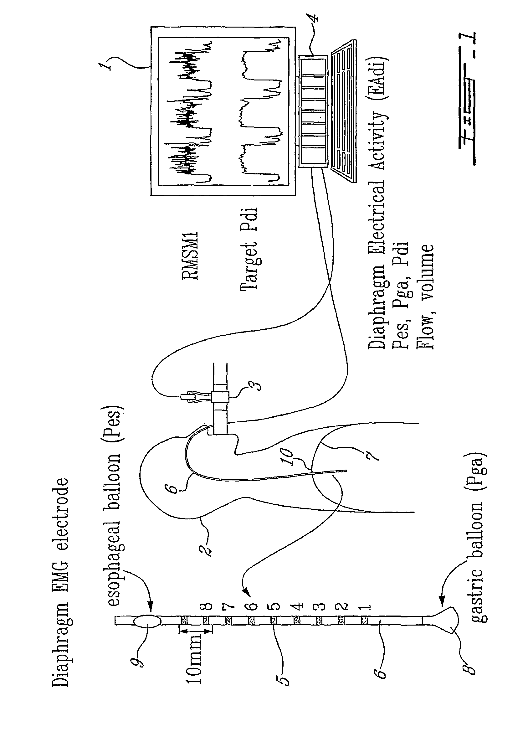 Method and device using myoelectrical activity for optimizing a patient's ventilatory assist
