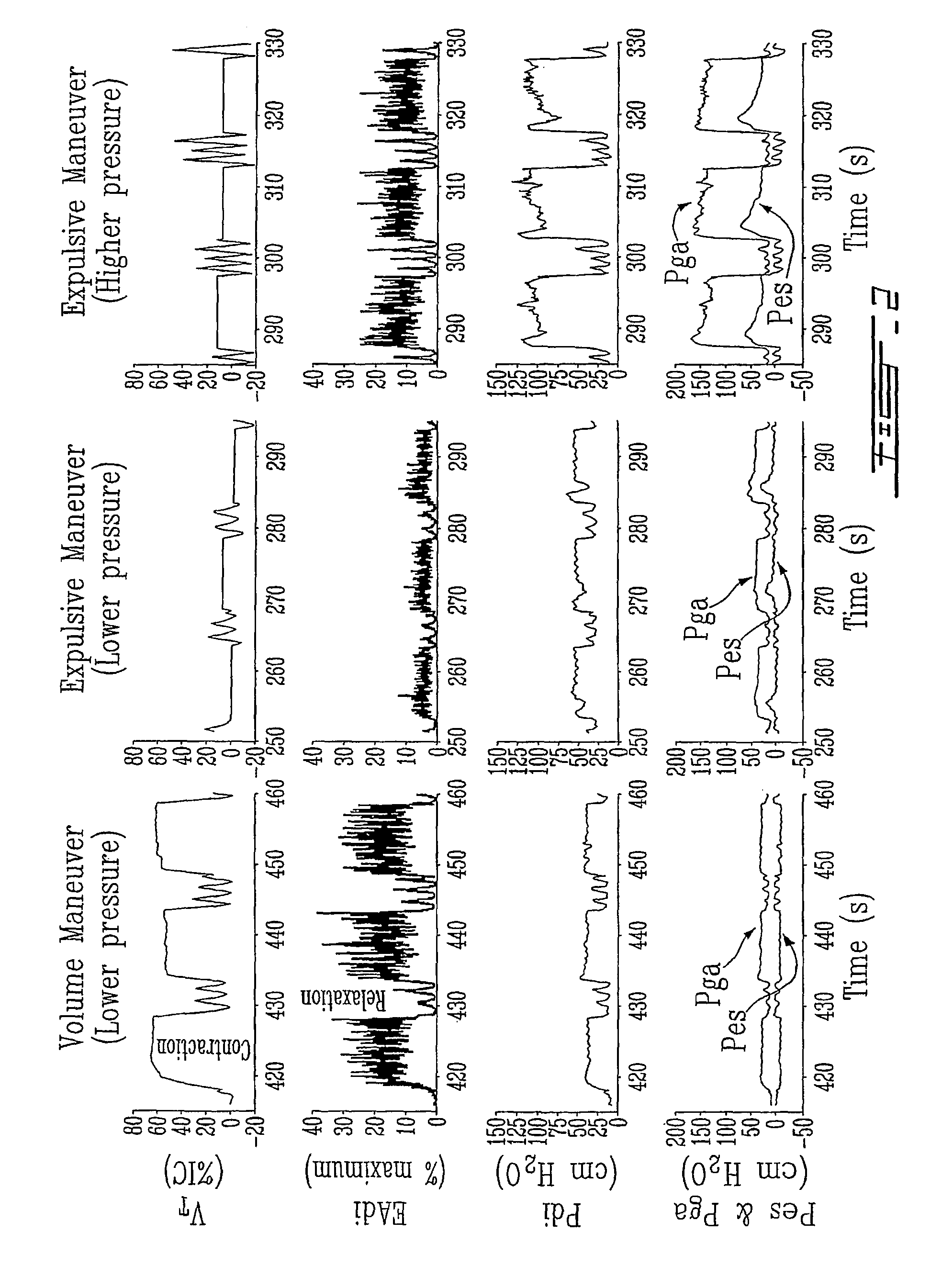 Method and device using myoelectrical activity for optimizing a patient's ventilatory assist