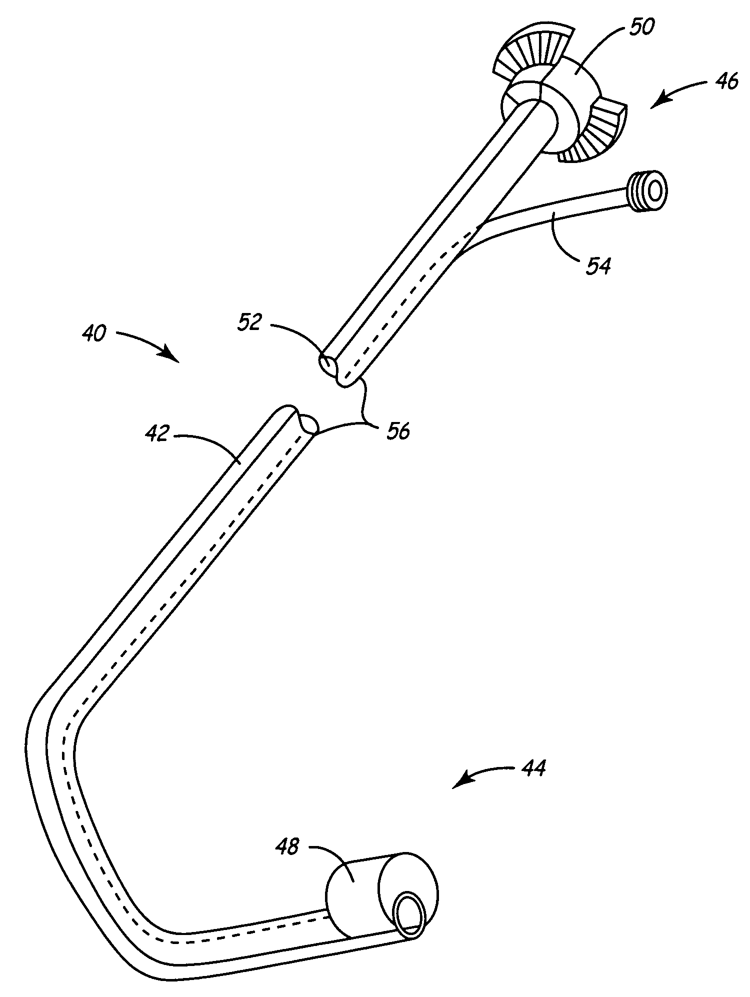 Method and apparatus for endovenous pacing lead