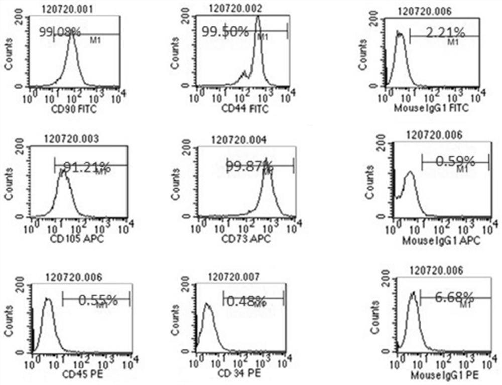 Isolation and culture method of adipose stem cell