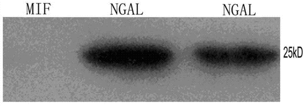 B cell epitope peptide of human neutrophil gelatinase associated lipocalin and application thereof