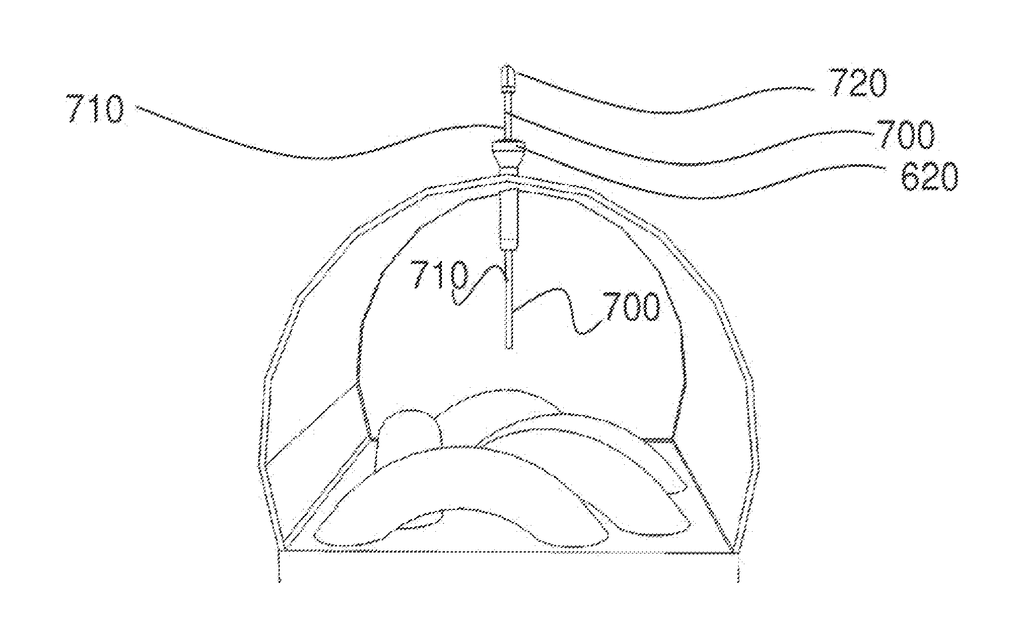 Methods and devices for laparoscopic surgery