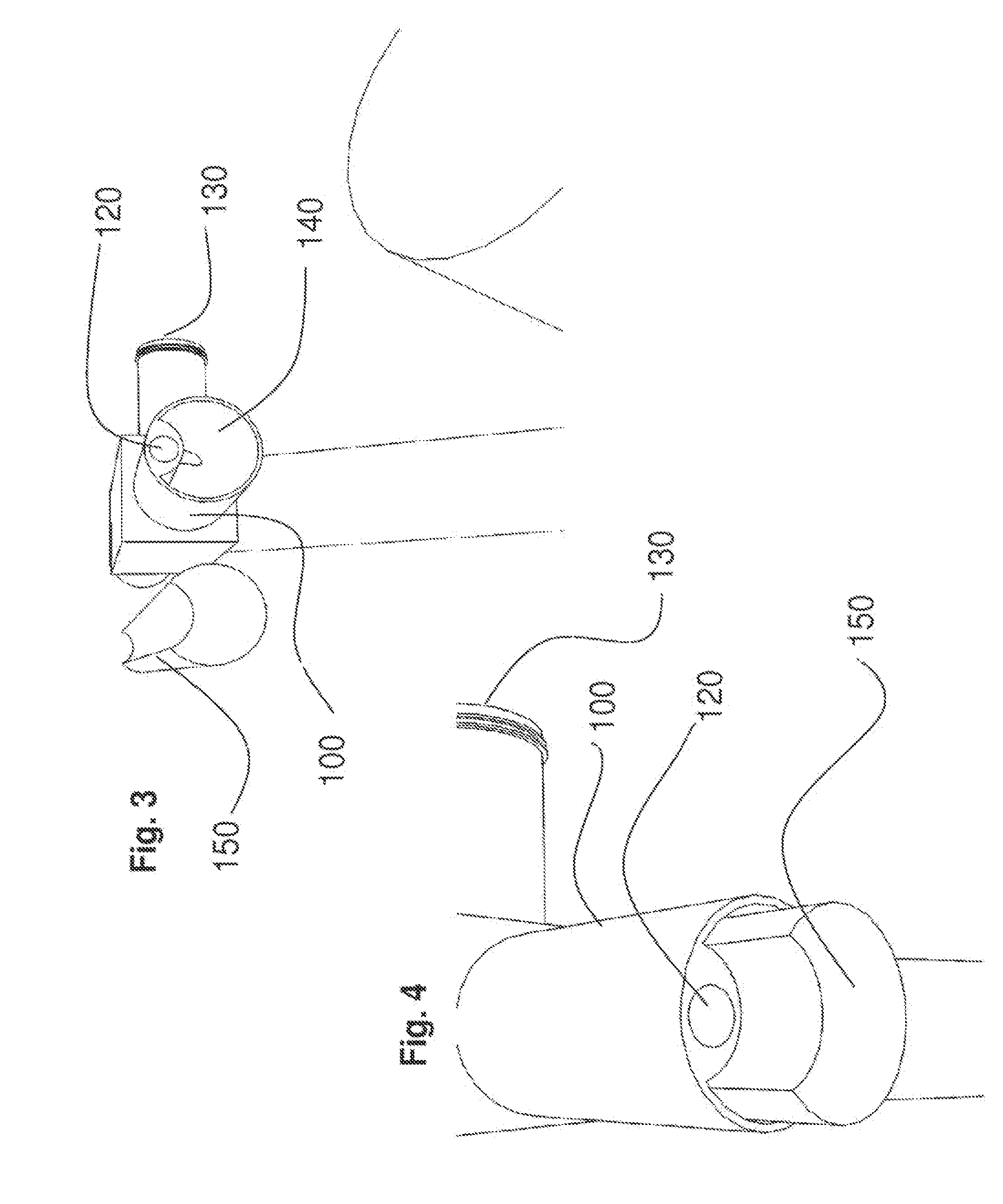 Methods and devices for laparoscopic surgery