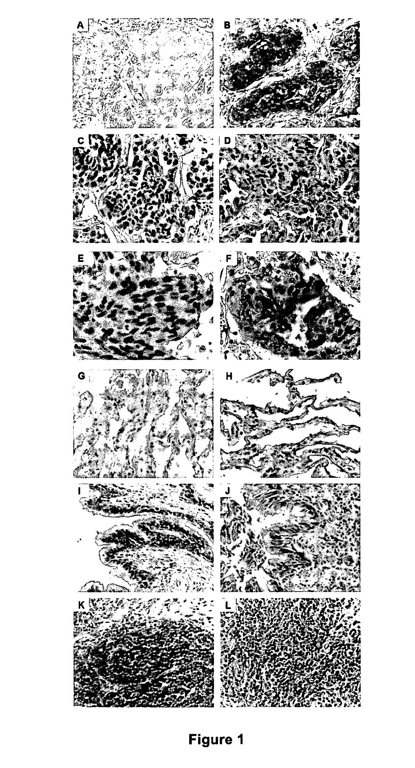 Methods for Predicting the Response to Anti-Cancer Treatment with an Agonist of TLR7 or an Agonist of TLR8