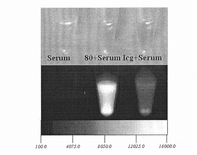 Application of near infrared fluorescent chemical in lymphaden imaging and angiogram