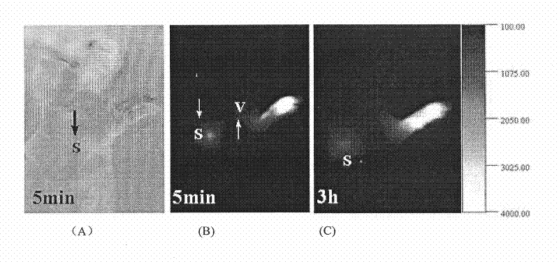 Application of near infrared fluorescent chemical in lymphaden imaging and angiogram