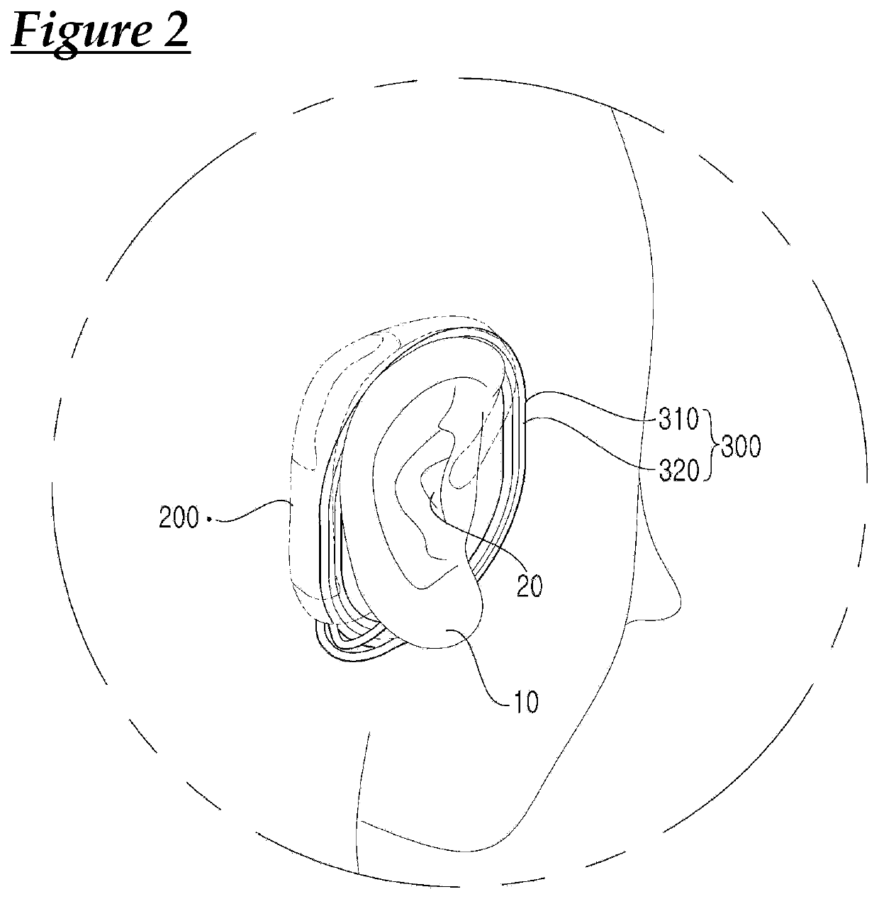 Cochlear implant