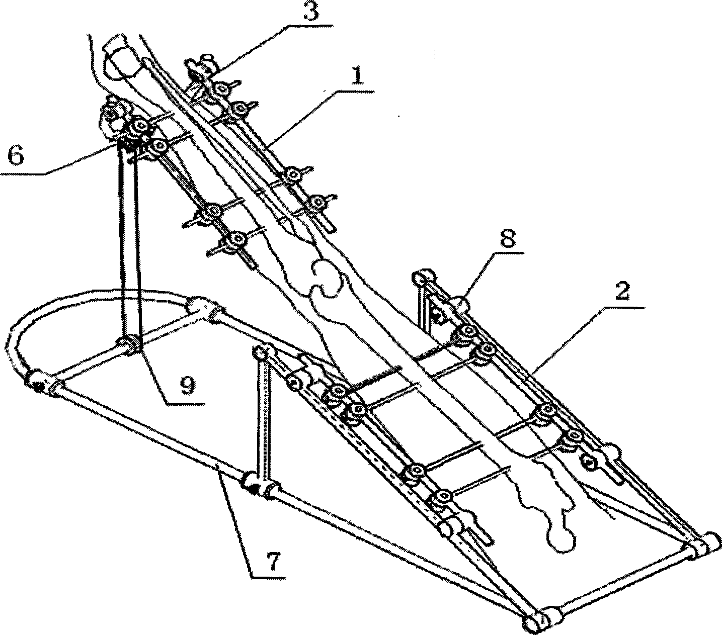 External fixing rack gradually pulling device and method for treating stiff knee