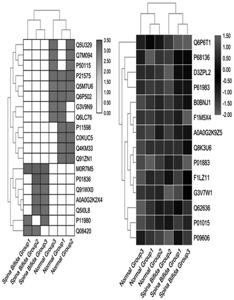 Molecular marker for antenatal noninvasive diagnosis of fetus with neural tube malformation, congenital heart disease or cleft lip and palate and application of molecular marker