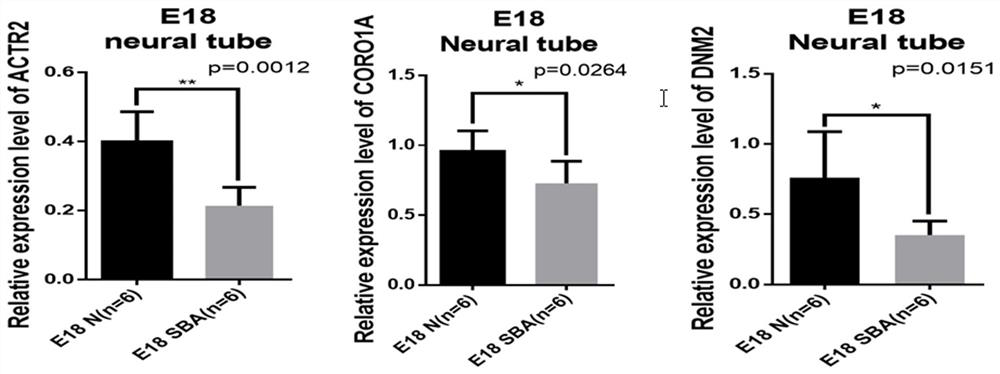 Molecular marker for antenatal noninvasive diagnosis of fetus with neural tube malformation, congenital heart disease or cleft lip and palate and application of molecular marker