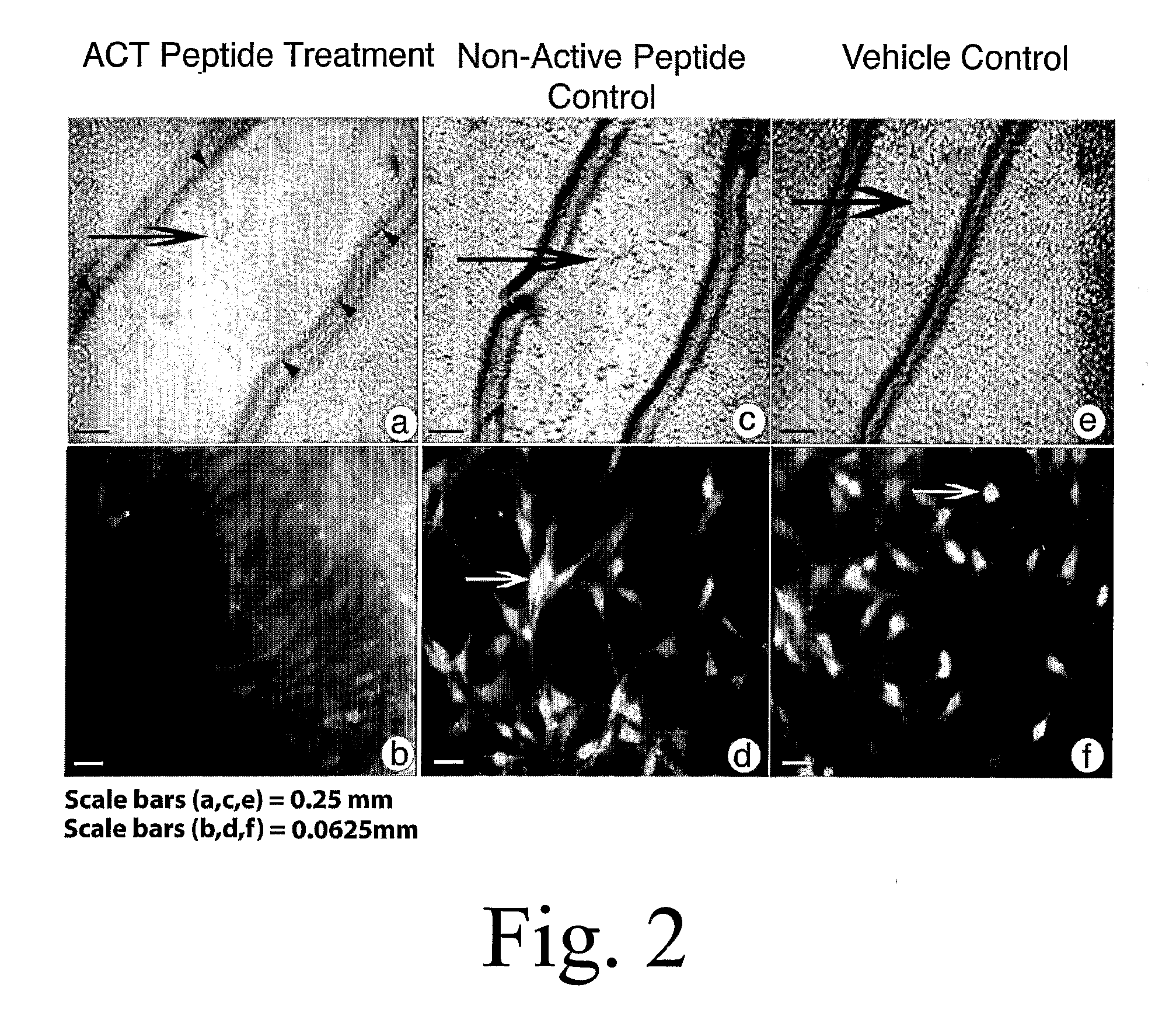 Composition and Methods for Promoting Wound Healing and tissue Regeneration
