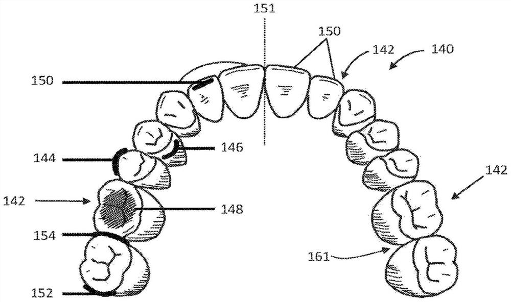 Systems and methods for personalized oral care