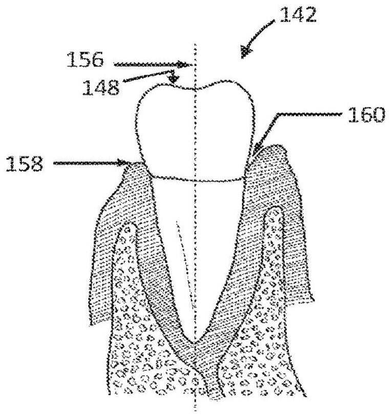 Systems and methods for personalized oral care