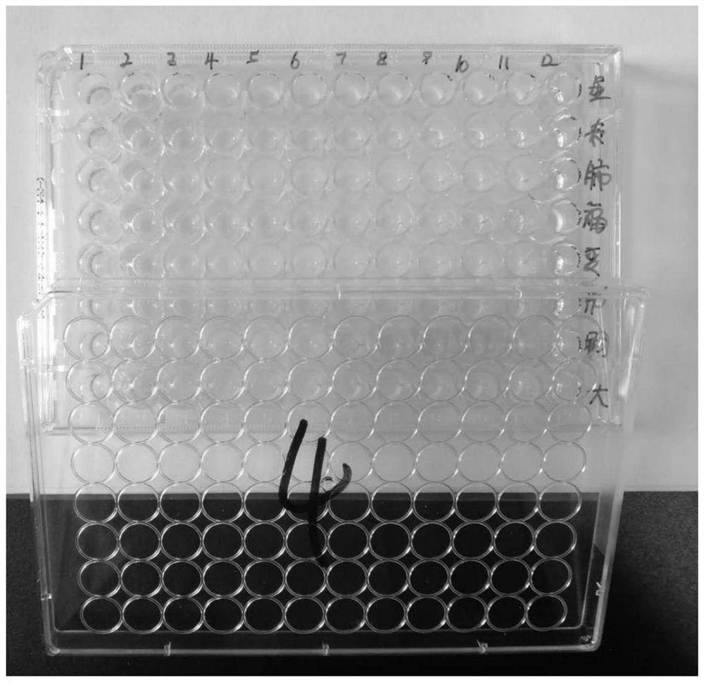 Application of cerasus humilis extract in preparation of antibacterial products