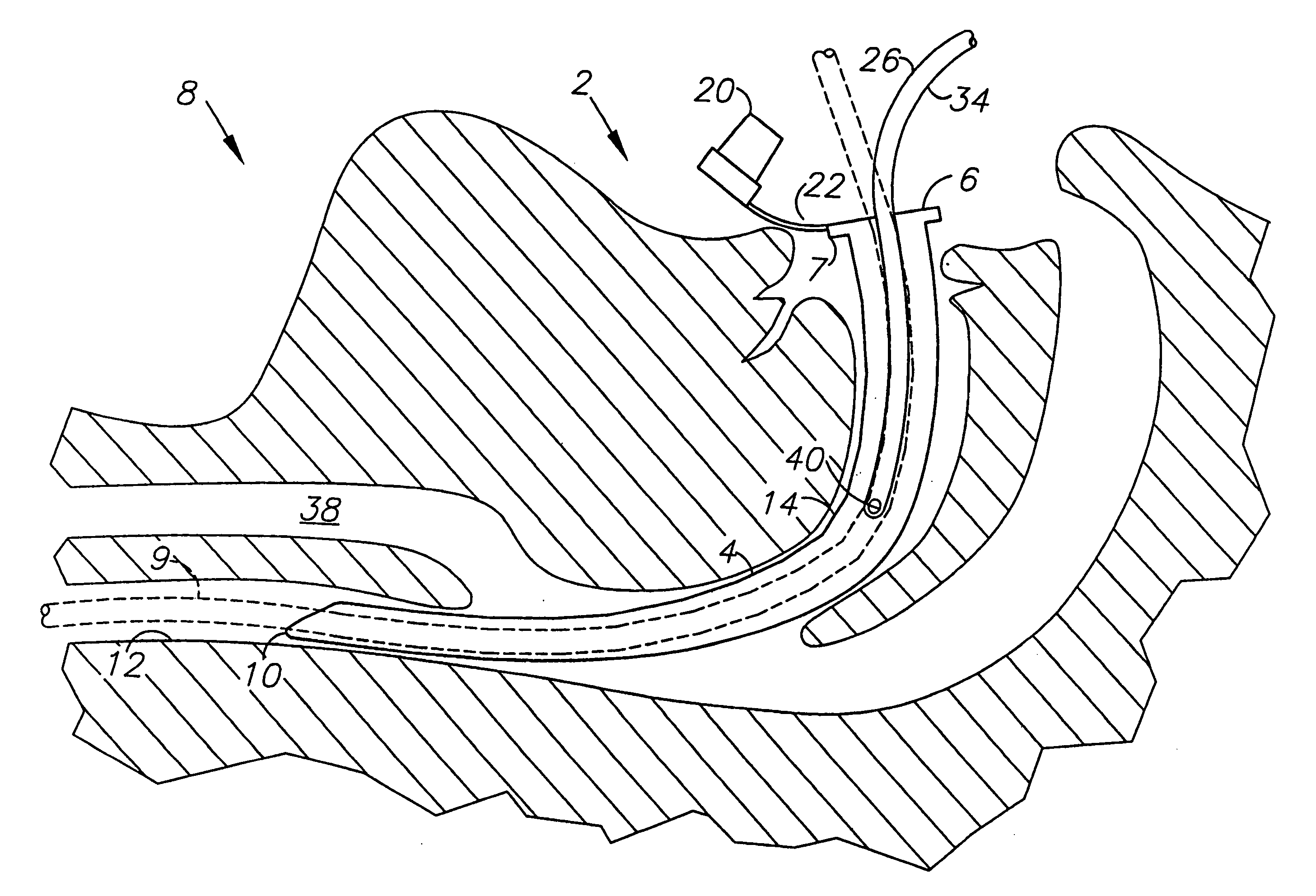 Esophageal intubation and airway management system and method