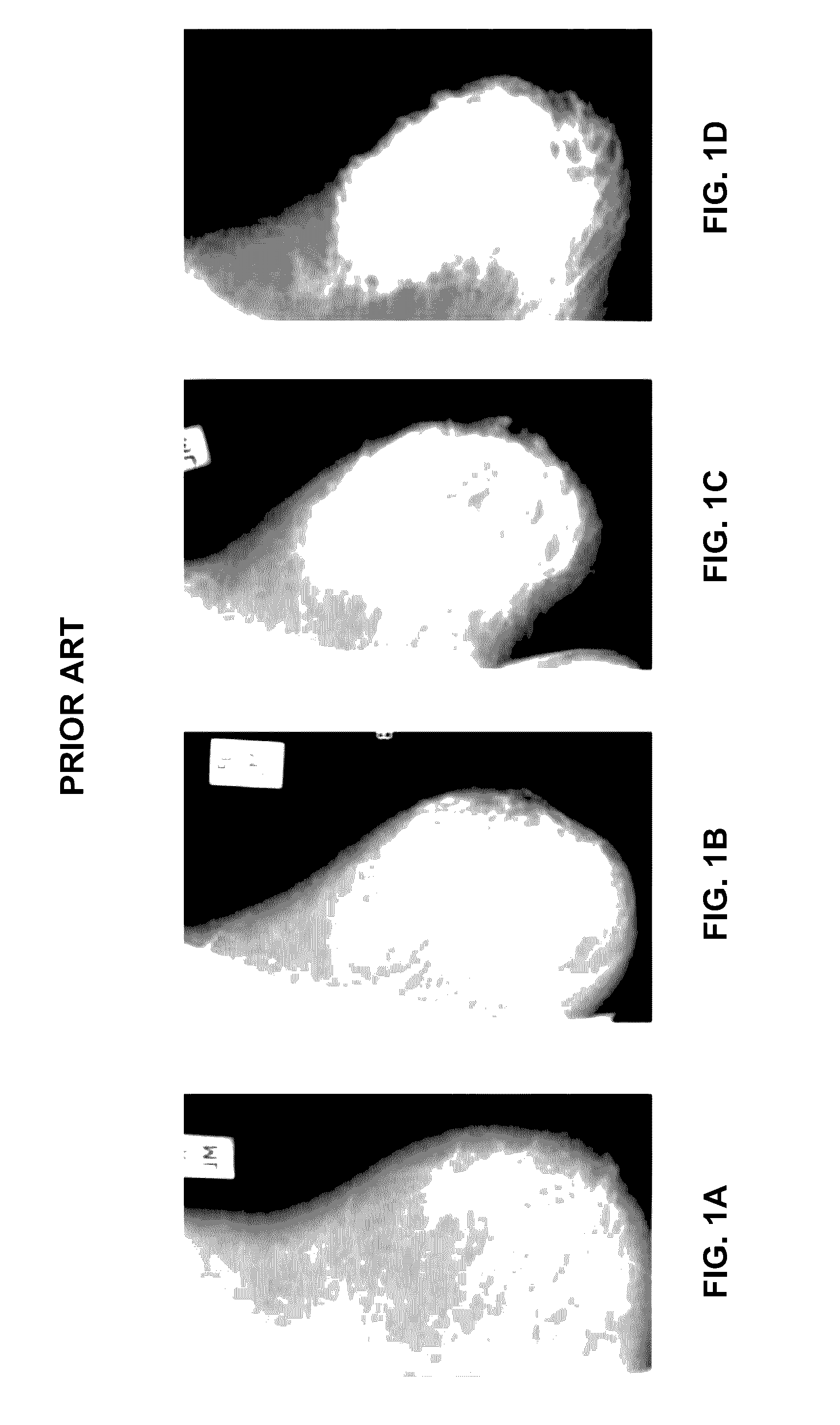 Method, system and computer program product for breast density classification using parts-based local features