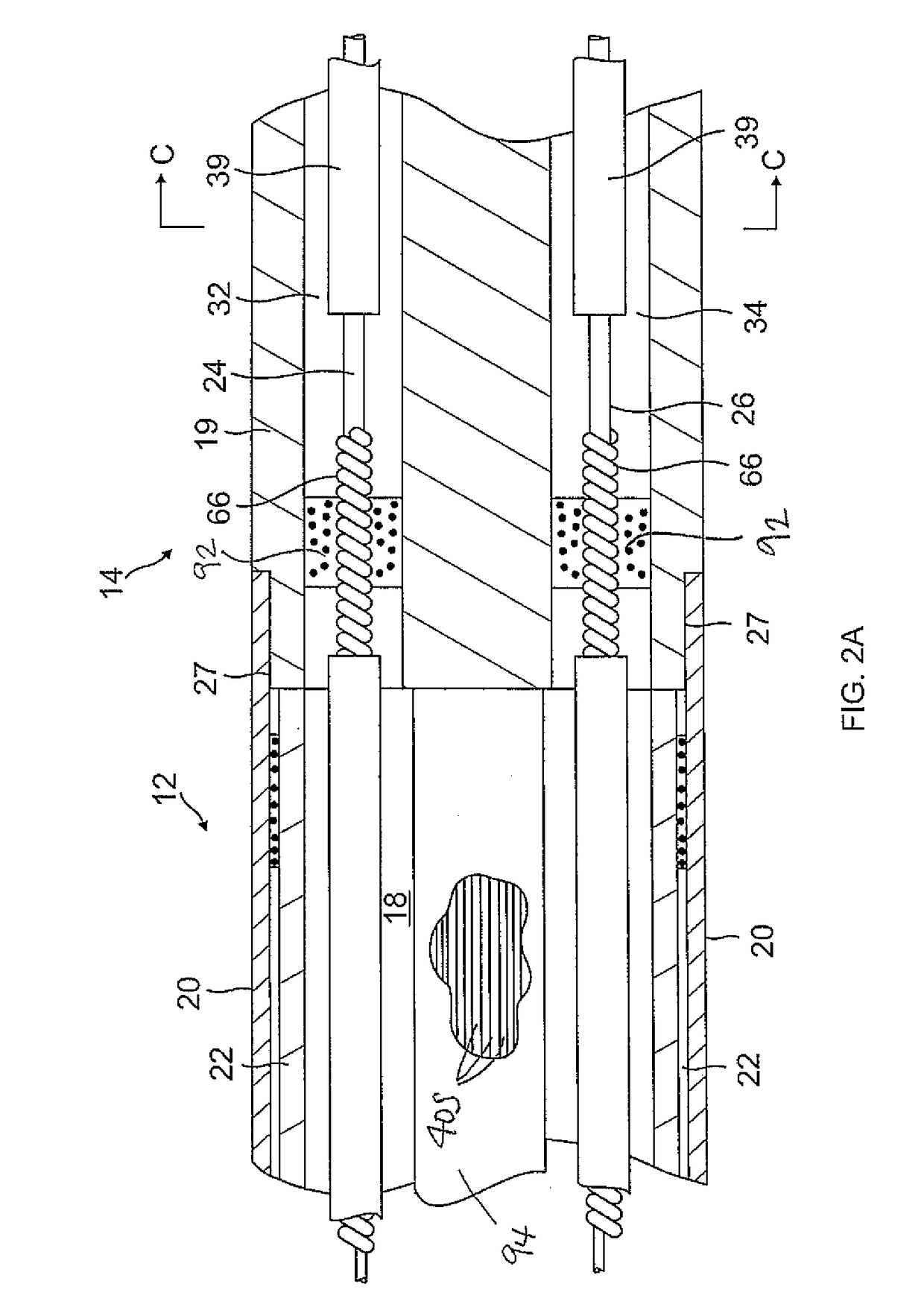 Catheter having closed loop array with in-plane linear electrode portion