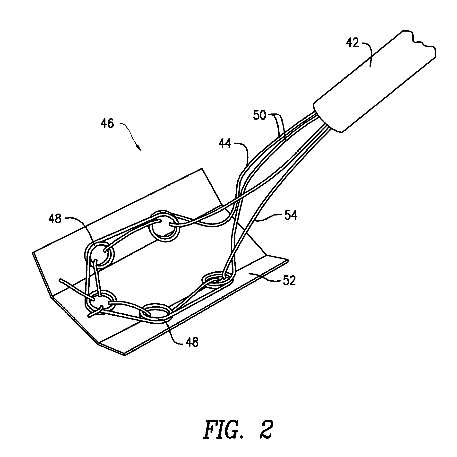 Augmentation delivery device