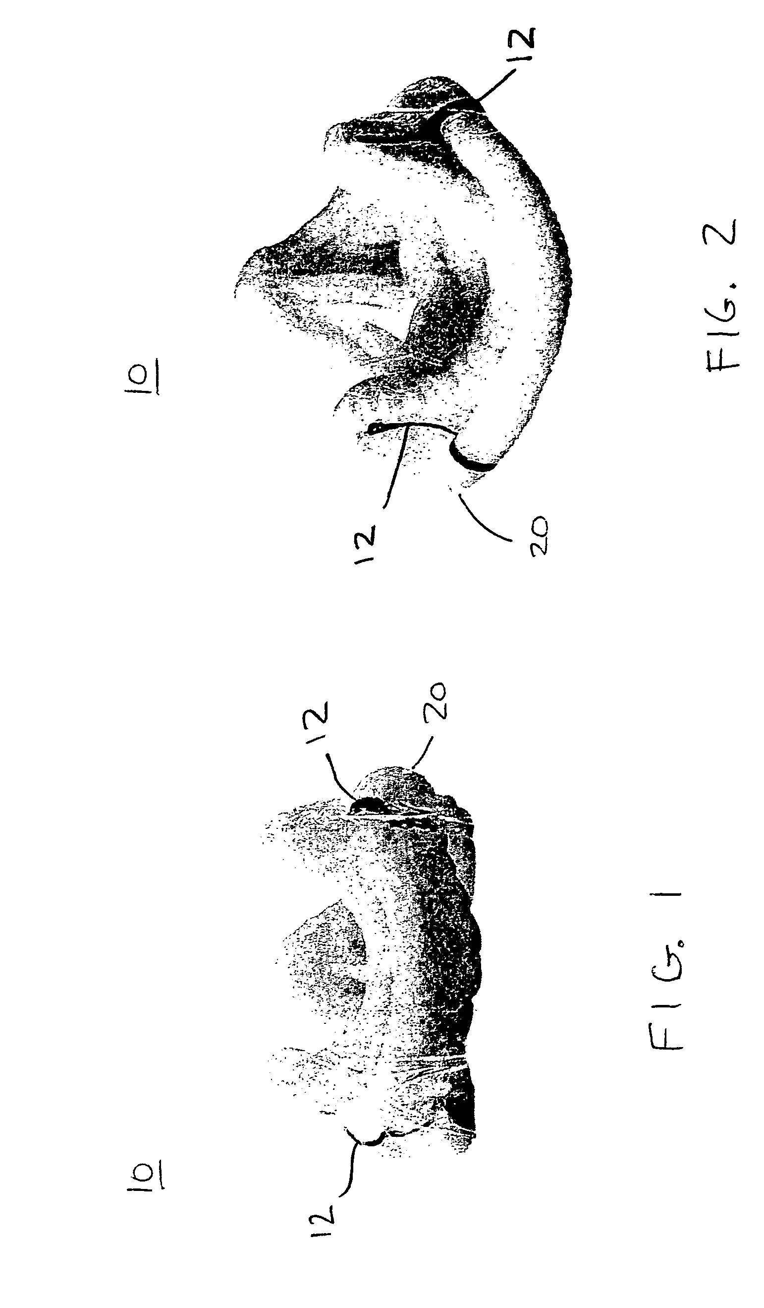 Synthetic blood vessel grafts