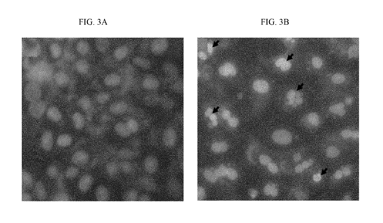 Pharmaceutical composition for treating cancer and a method thereof