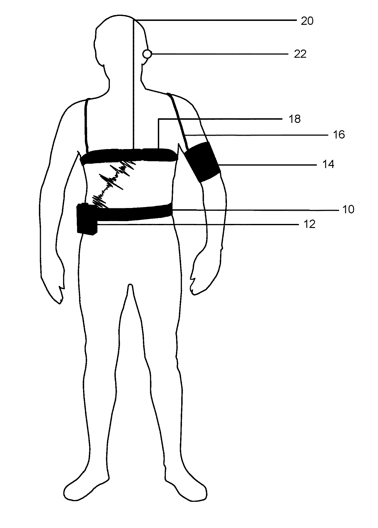 Method of operating a long-term blood pressure measurement device