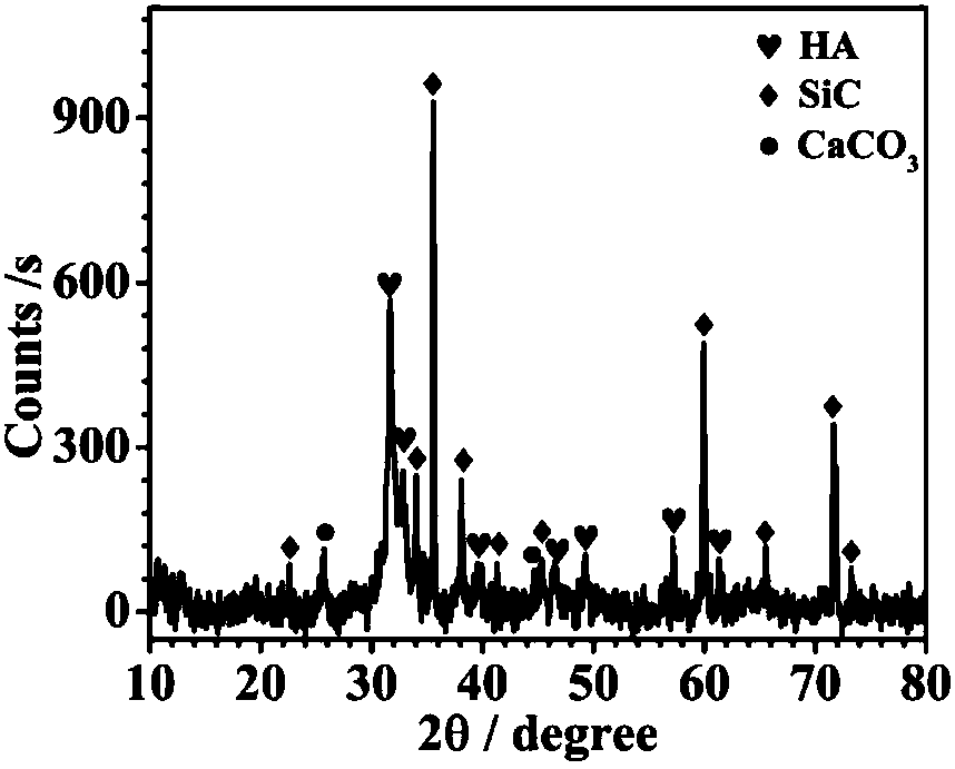 Carbon/carbon composite material modified by silicon carbide and hydroxyapatite gradient coating and preparation method thereof