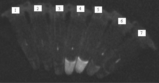 Rapid detection kit for pathogenic bacteria of phoma stem canker and using method of rapid detection kit