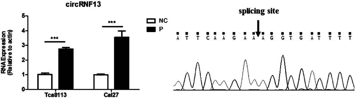 Application of reagent for detecting ring-shaped RNA (ribonucleic acid) circRNF13 in preparing tongue squamous carcinoma auxiliary diagnosis preparation