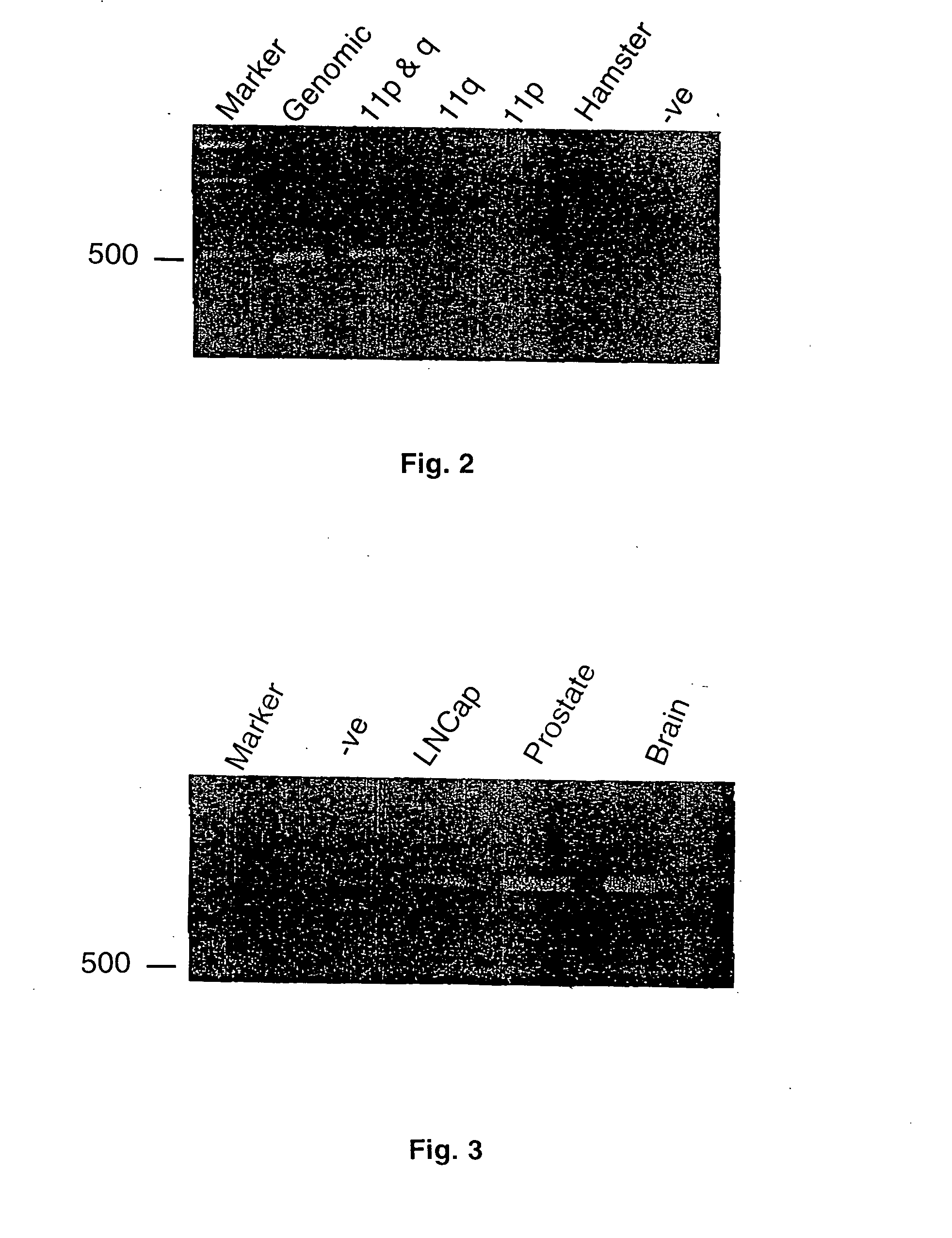 DNA encoding the prostate-specific membrane antigen-like gene and uses thereof
