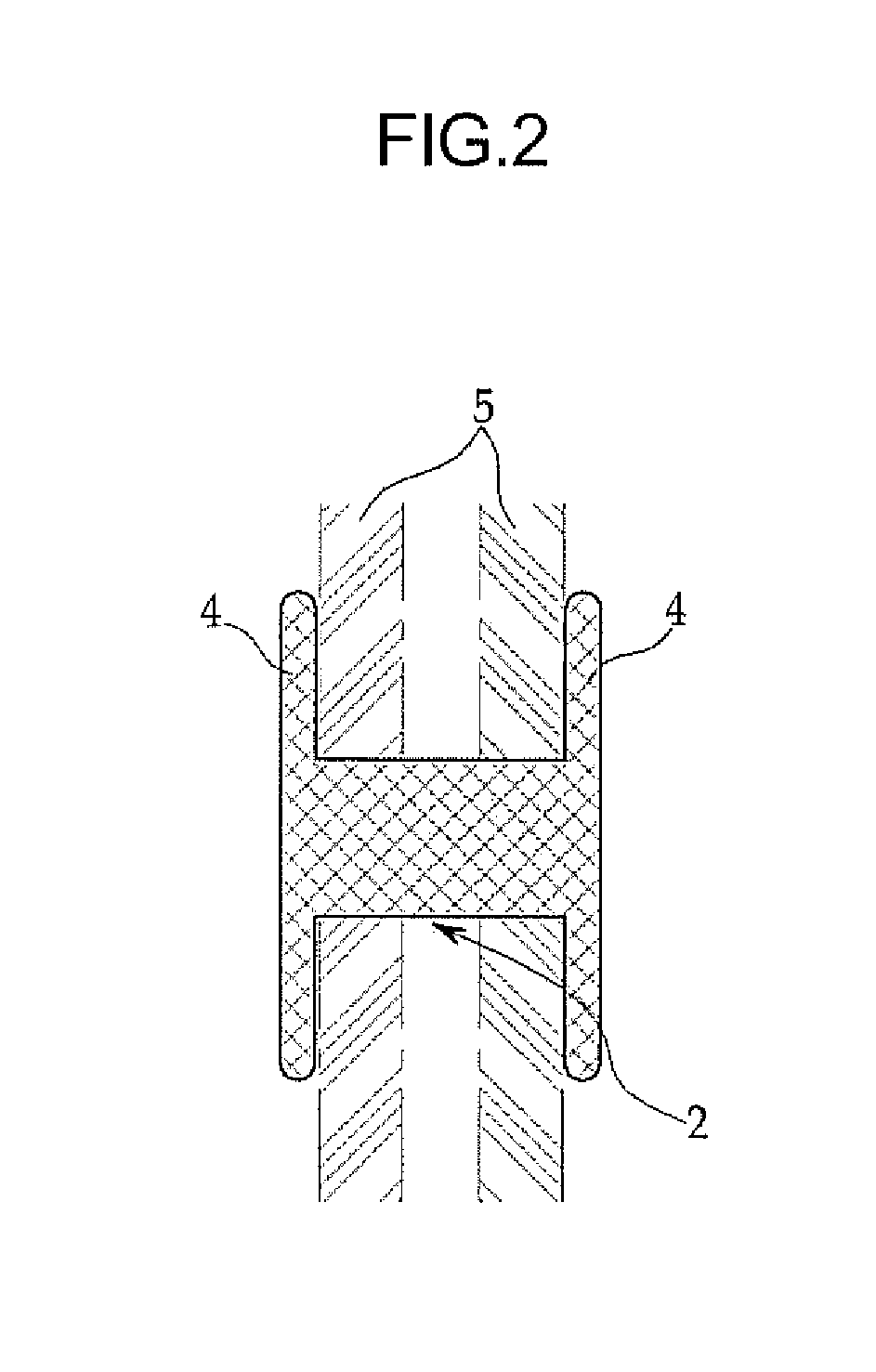 Stent for connecting adjacent tissues of organs