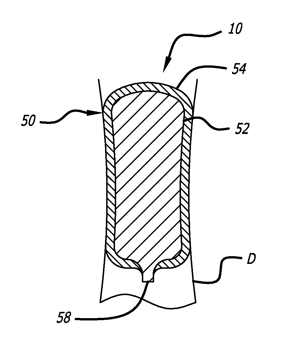 Method and Apparatus For Occluding A Lumen