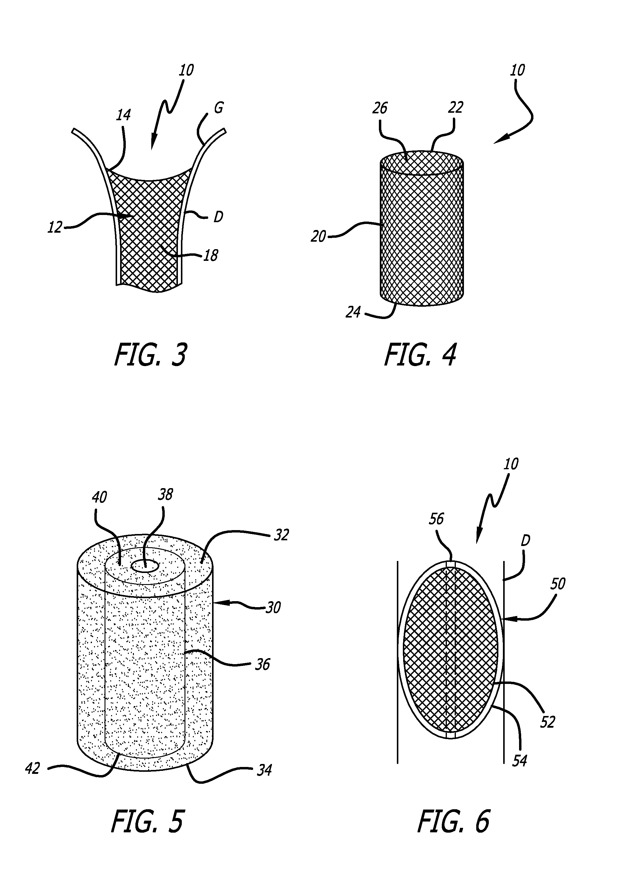 Method and Apparatus For Occluding A Lumen