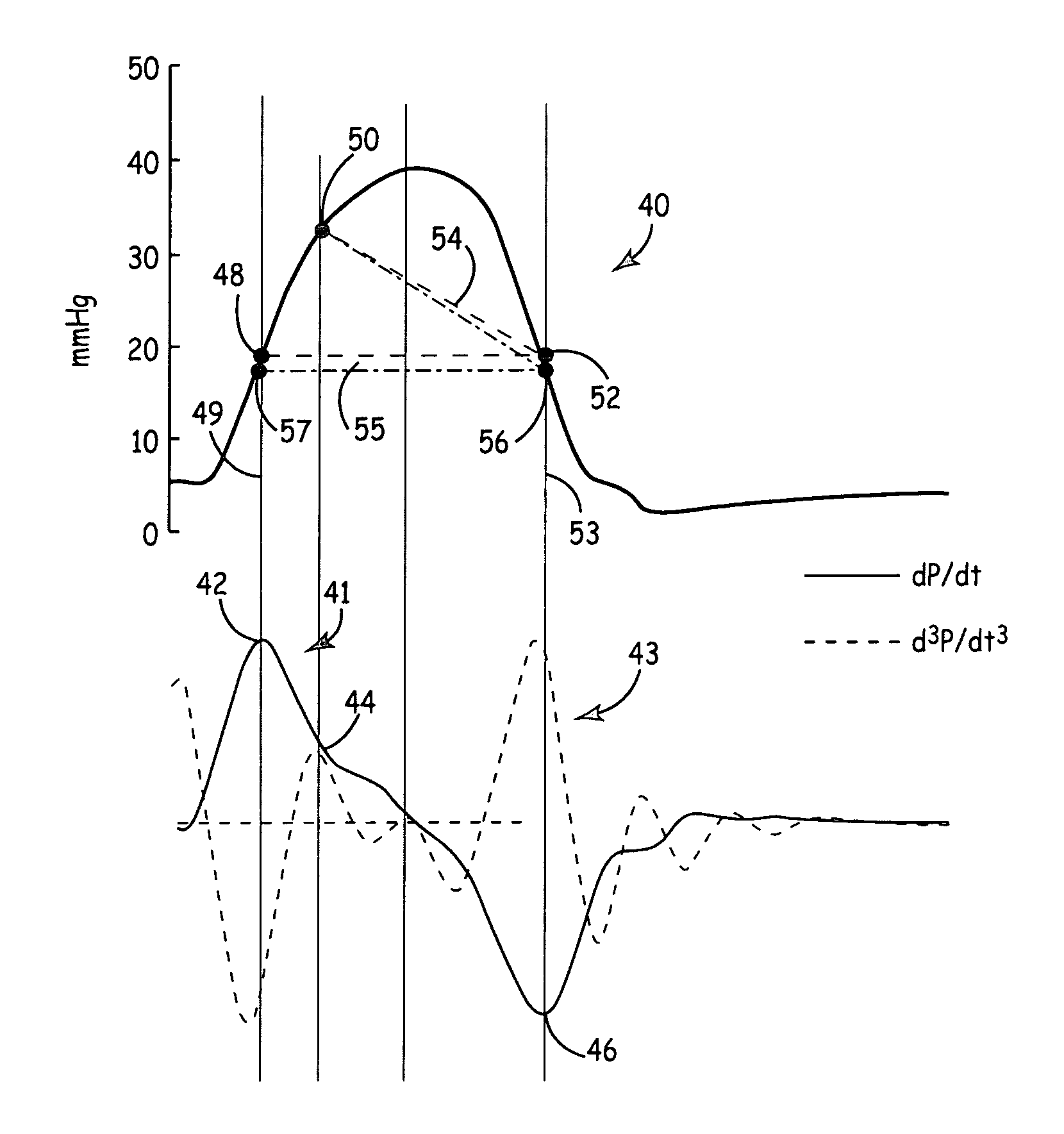 Derivation of flow contour from pressure waveform