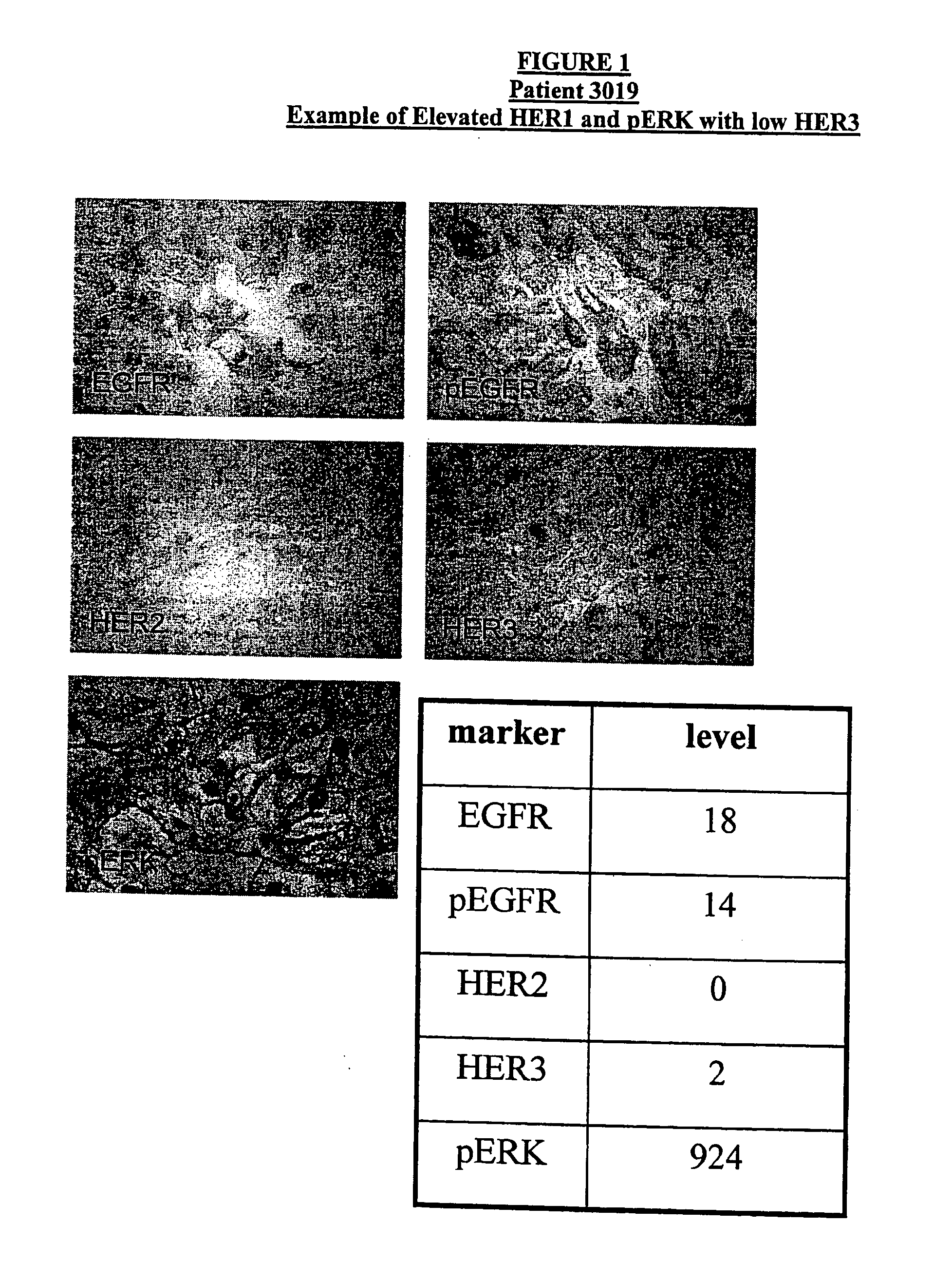 Method for Predicting Response to Epidermal Growth Factor Receptor-Directed Therapy