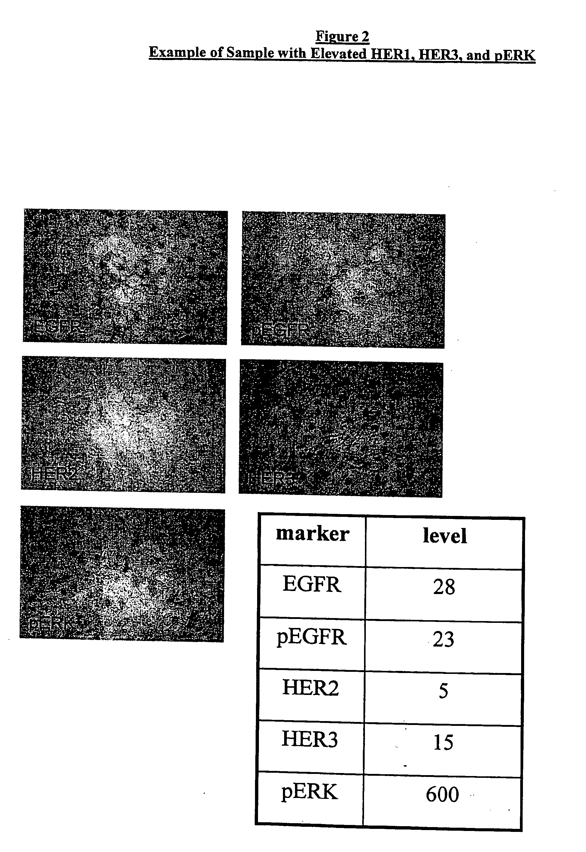 Method for Predicting Response to Epidermal Growth Factor Receptor-Directed Therapy