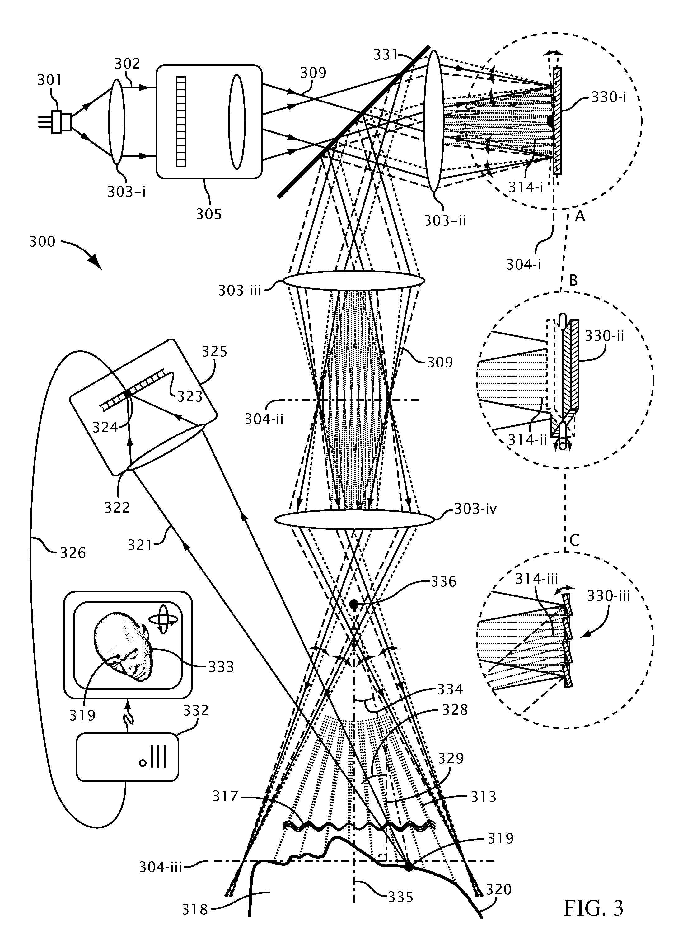 Systems and methods for suppressing coherent structured illumination artifacts
