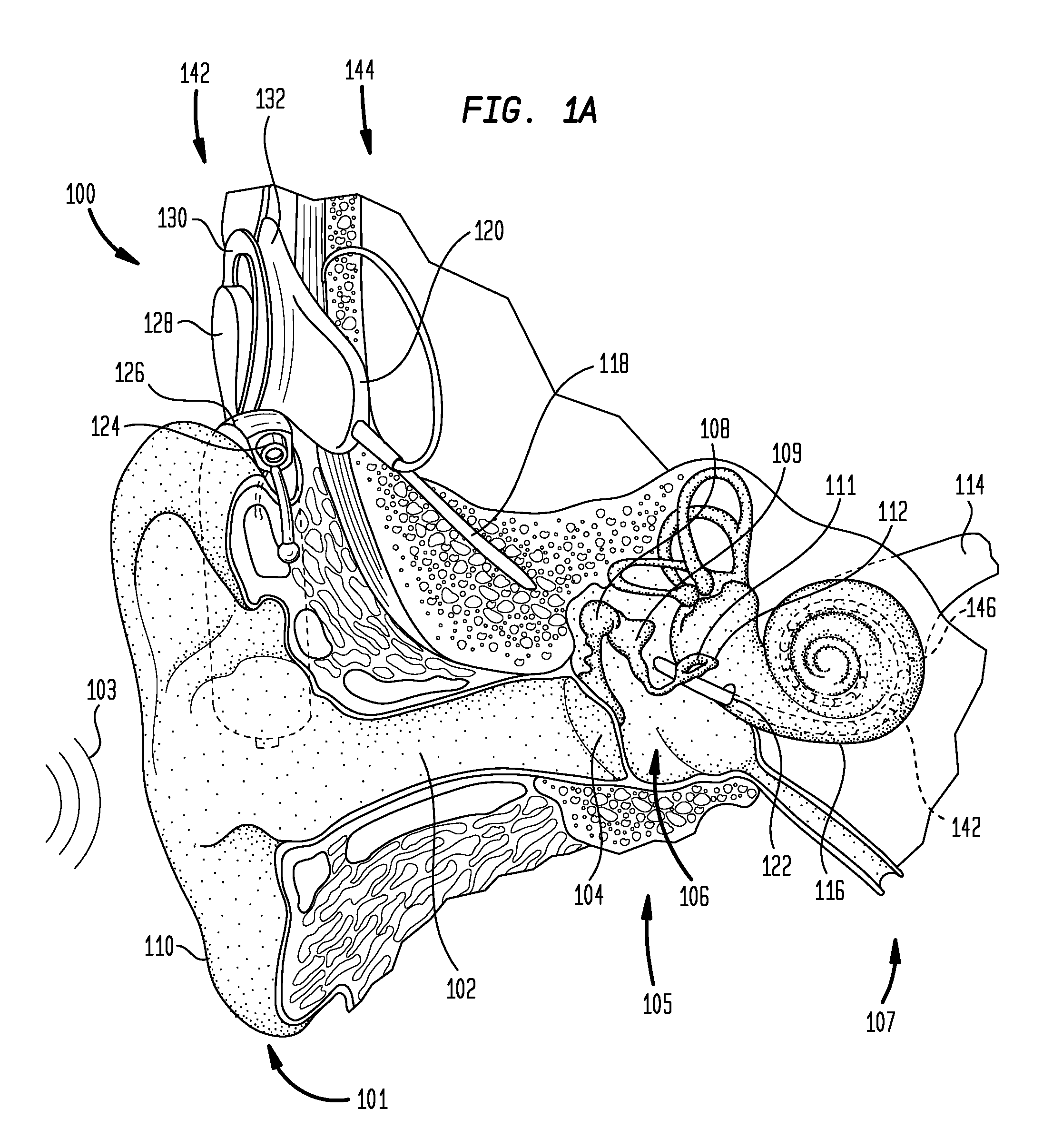 Provision of stimulus components having variable perceptability to stimulating device recipient