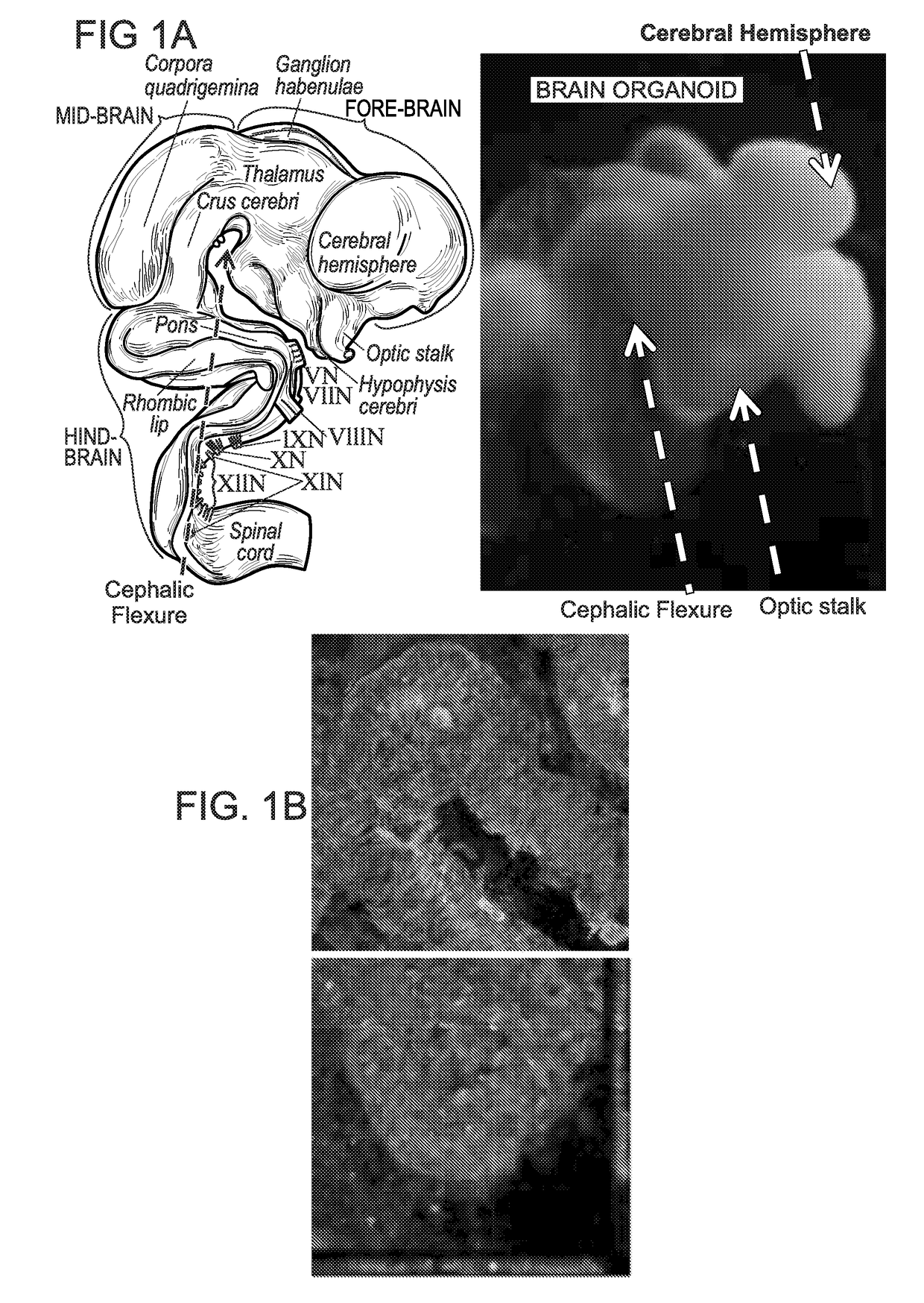 A neural organoid composition and methods of use
