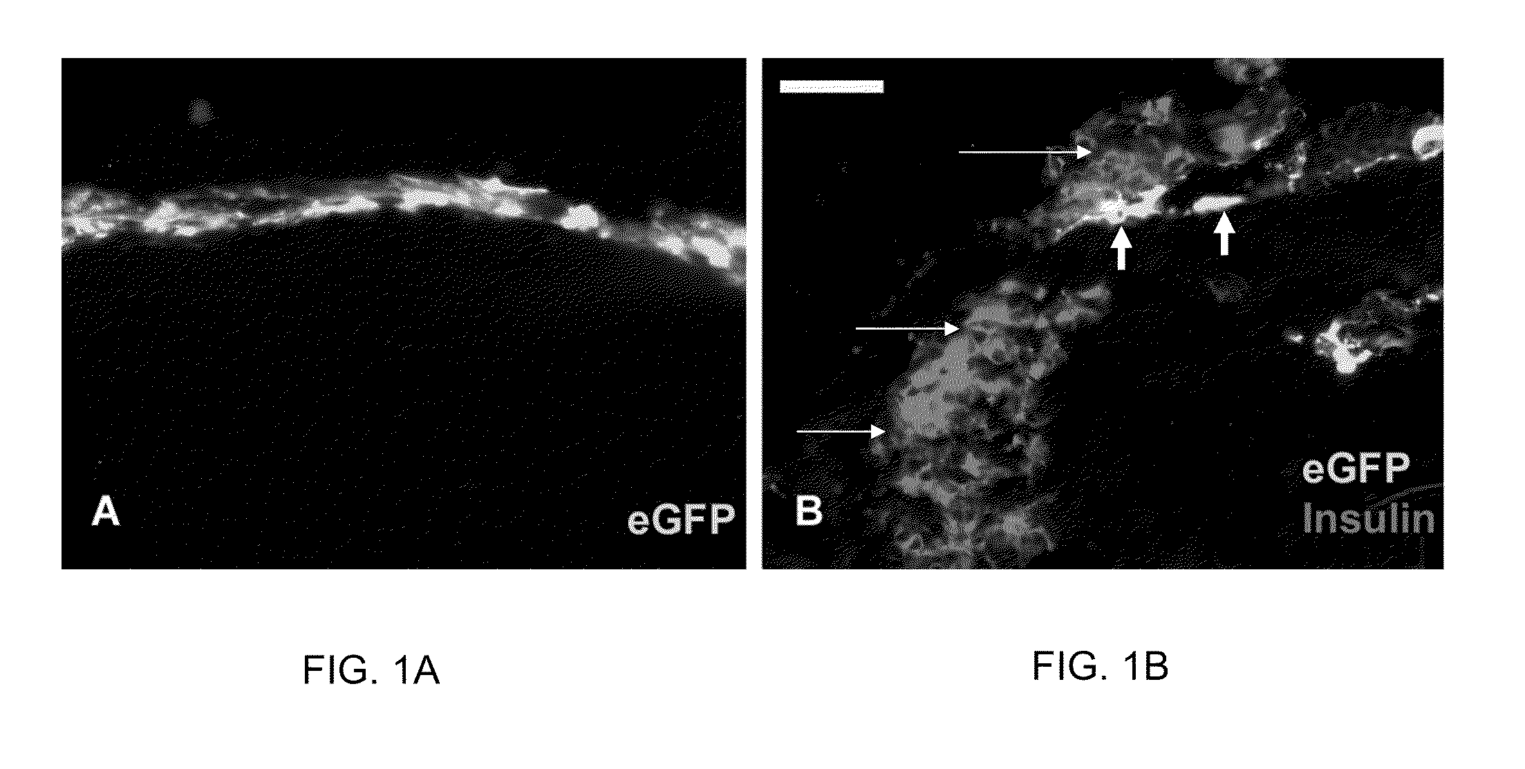 Methods and Kits for Enhancing Cell Survival, Stimulating Cell Proliferation, Treating Diabetic Patients, and/or Reinnervation