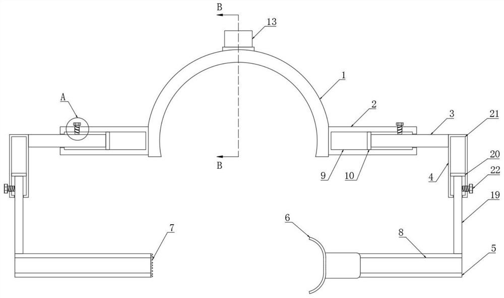 Reset fixing device and method for distal tibiofibular syndesmosis separation