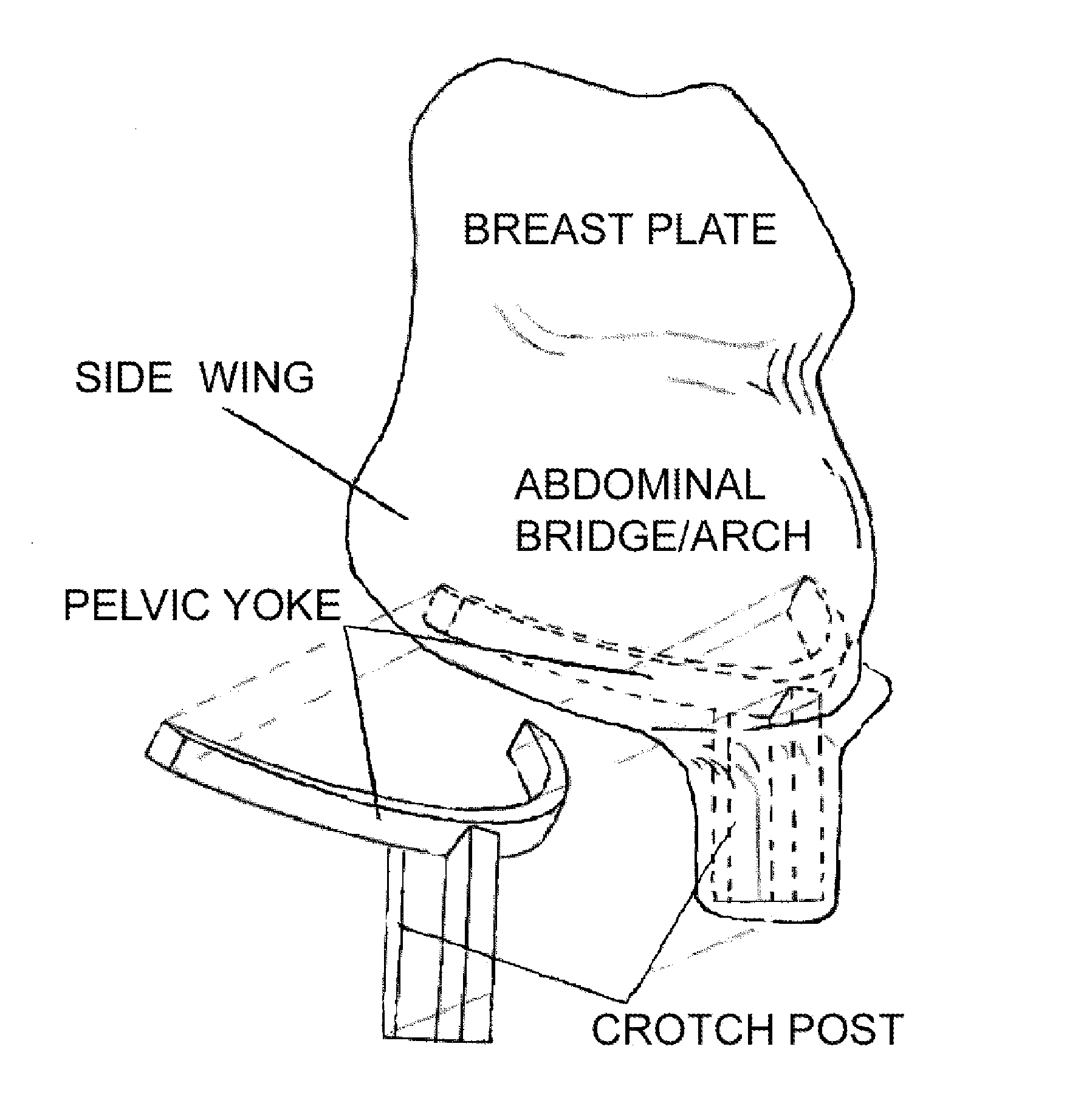 Method of Supplemental Automotive Restraint for Pregnant Women