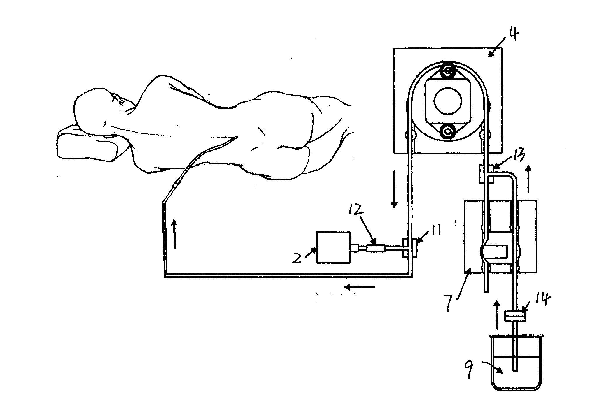 Cerebrospinal fluid external displacement instrument