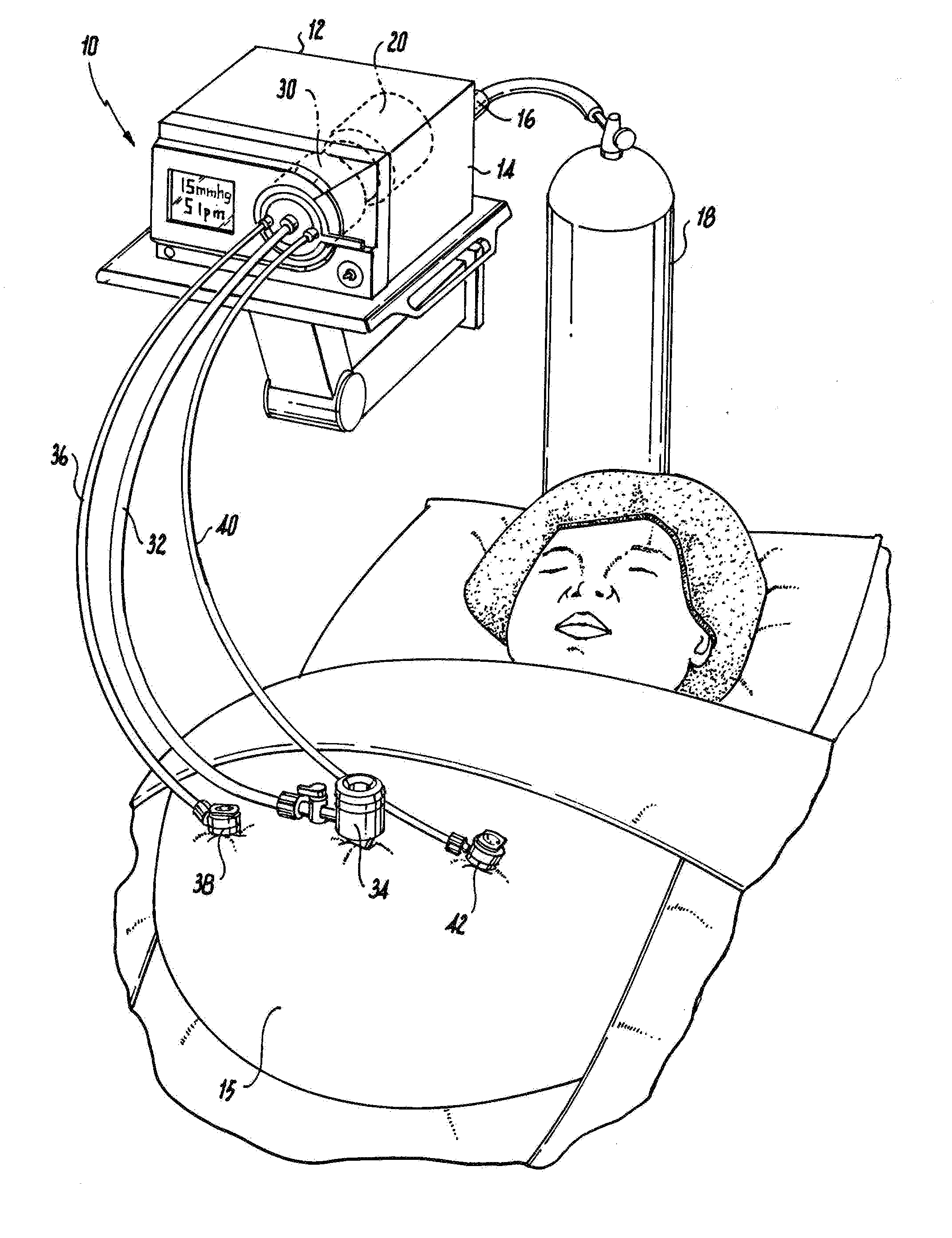 Filter cartridge with internal gaseous seal for multimodal surgical gas delivery system having a smoke evacuation mode