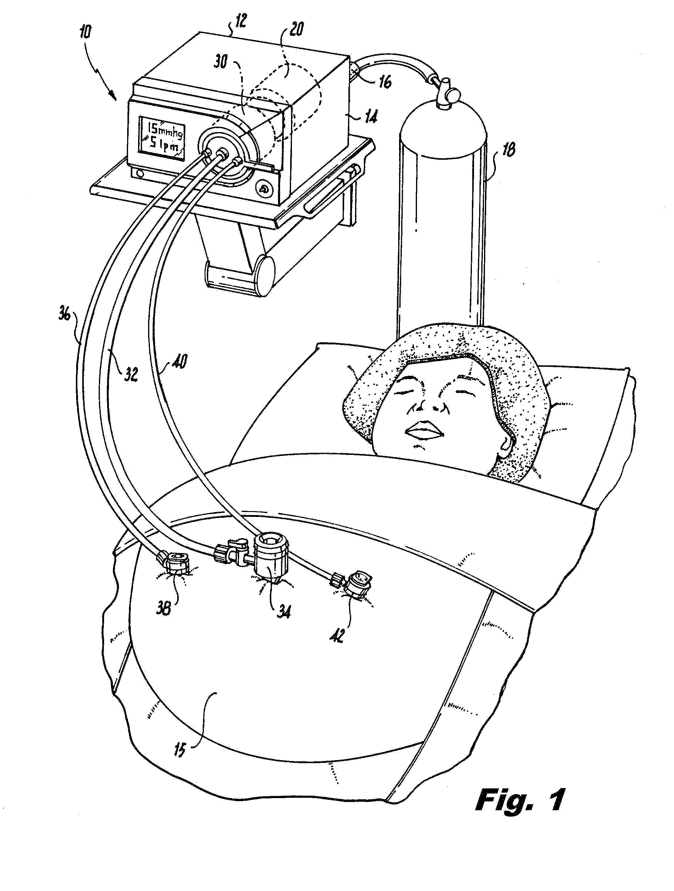 Filter cartridge with internal gaseous seal for multimodal surgical gas delivery system having a smoke evacuation mode