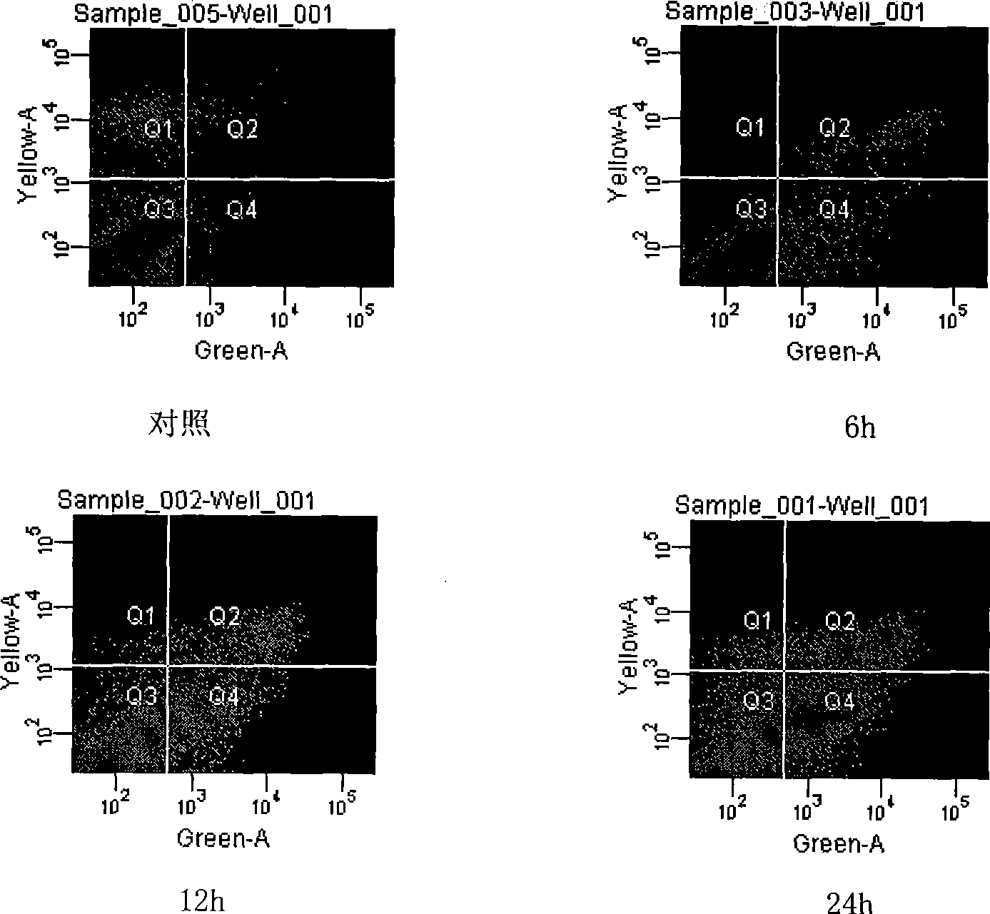 Loperamide hydrochloride as antineoplastic component and uses thereof