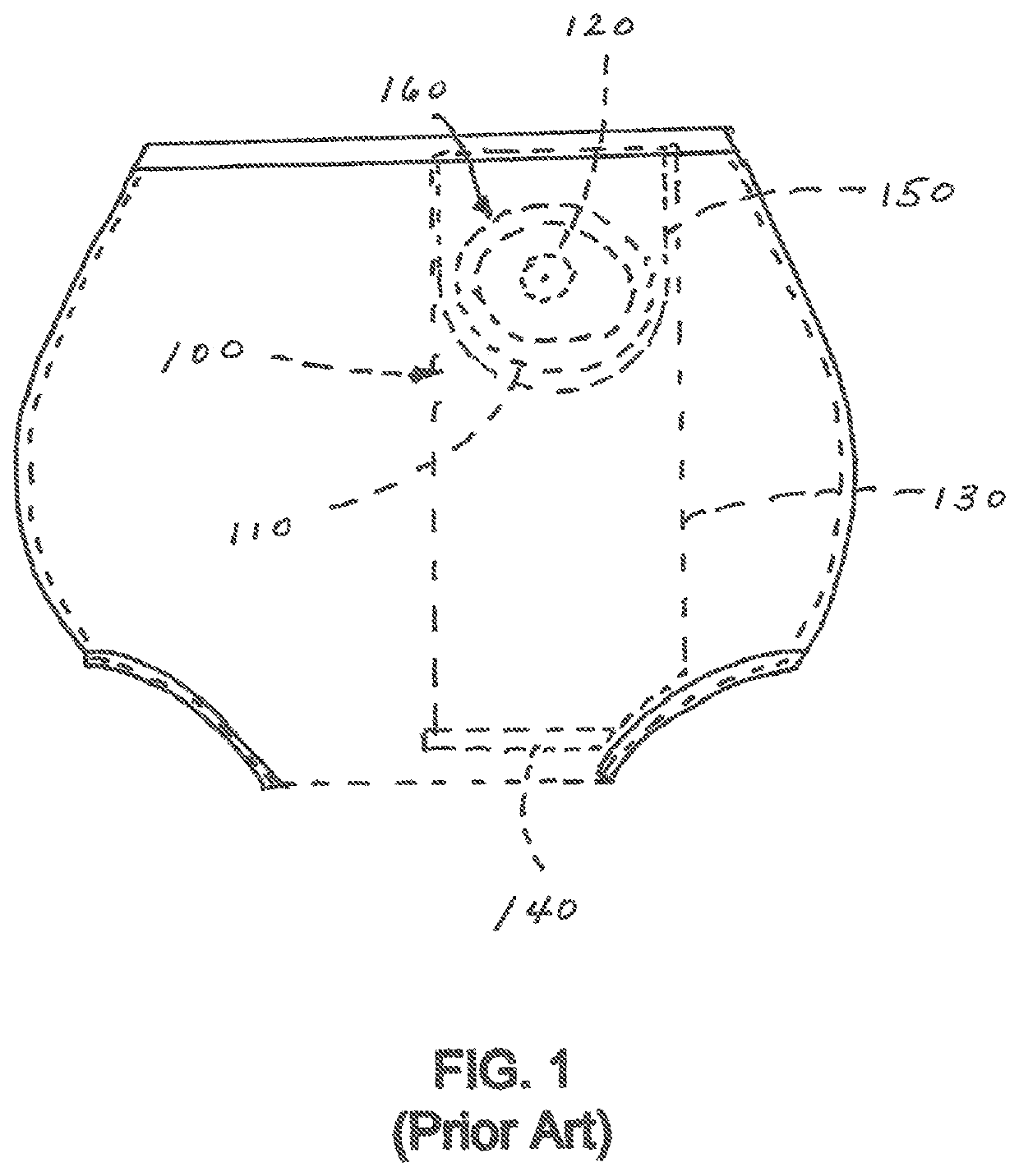 PD-Uwear: peritoneal dialysis undergarments