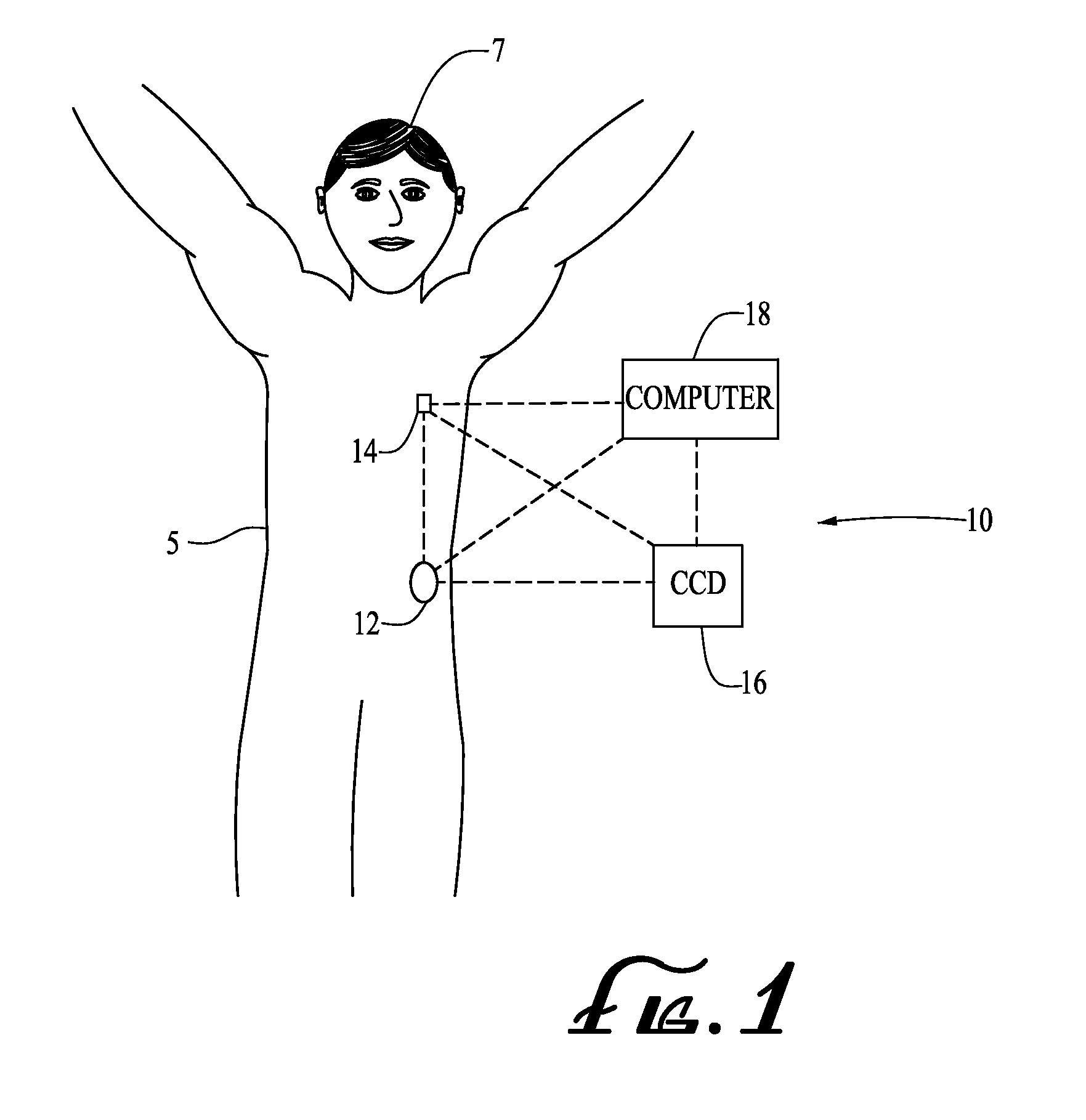 Transfer guard systems and methods