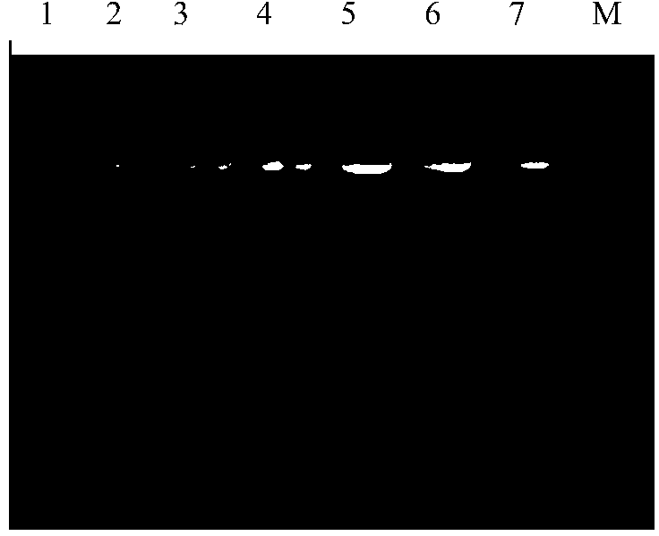 Fermentation medium and method for producing plasmid DNA vaccine pSVK-CAVA for treatment of melanoma by fermentation medium