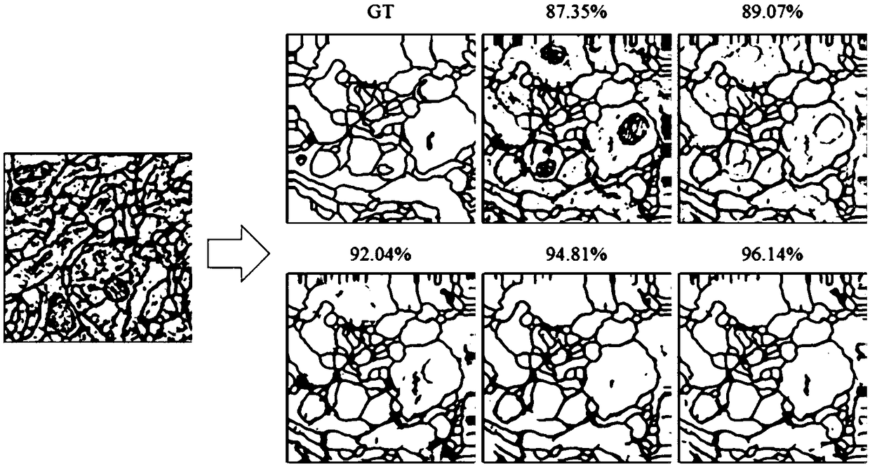 A MRI brain tumor image segmentation method based on optimized U-net network model