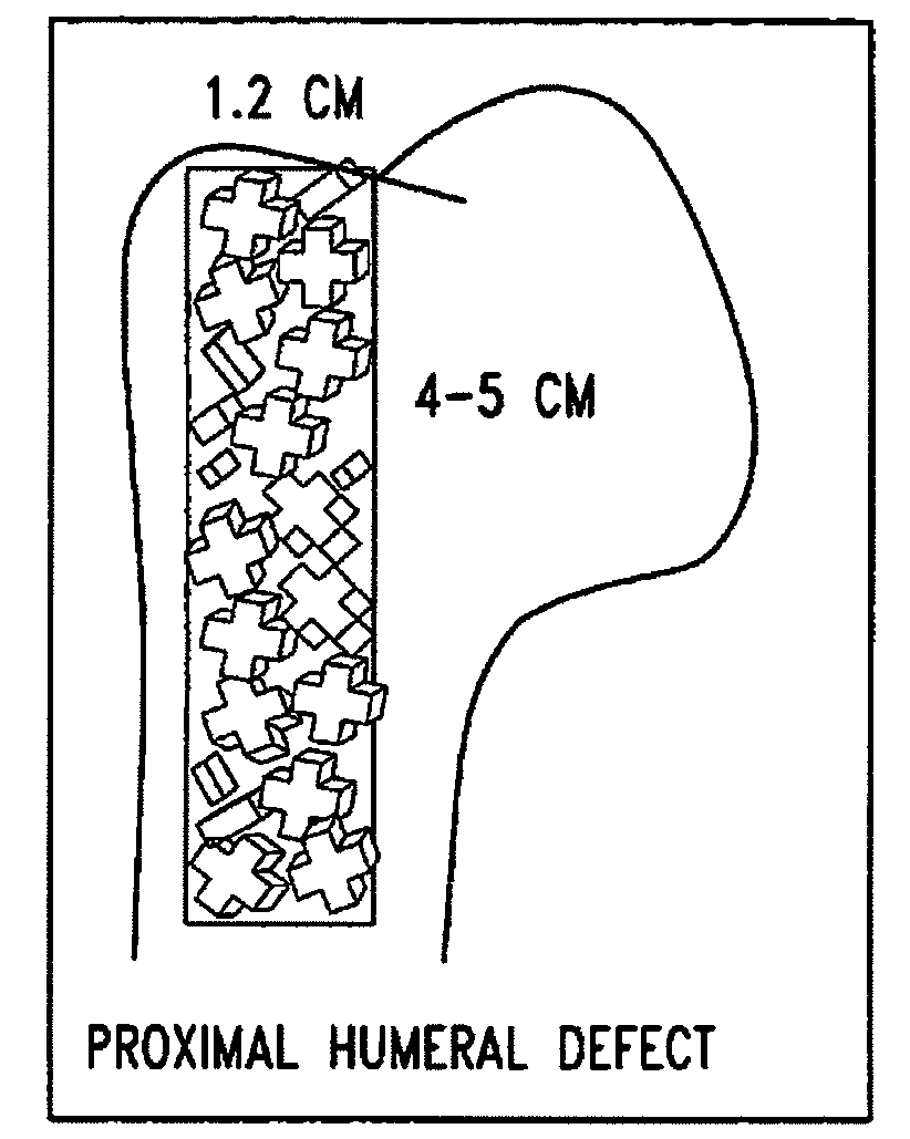 Bone void filler and method of manufacture